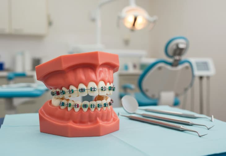 bracesc
